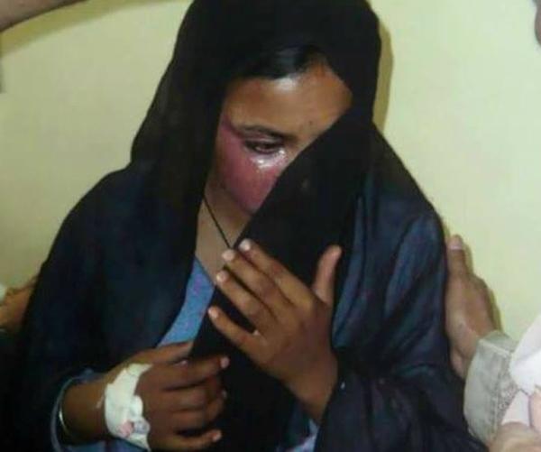 Pakistan: Kresťanka odmietla konvertovať a vydať sa, preto bola zapálená